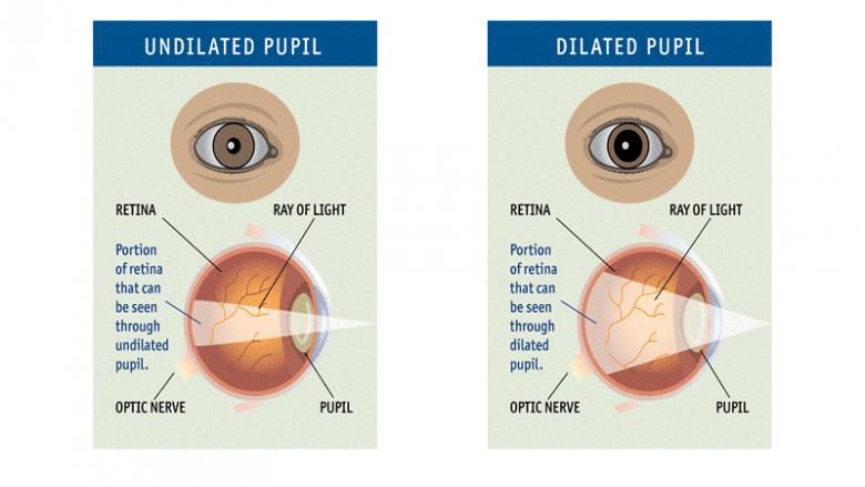 dilated vs. undilated
