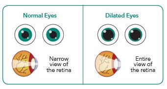 dilated eye exam diagram